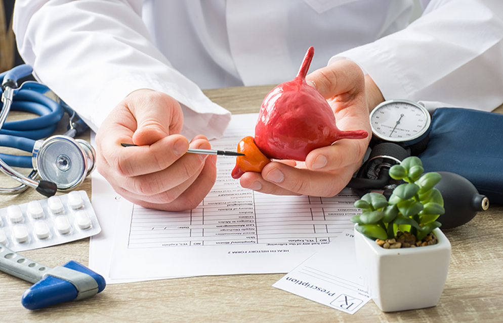 Médico mostrando modelo anatómico de próstata y vejiga